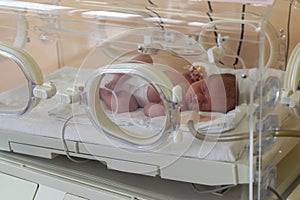 Premature newborn baby in the hospital incubator. Neonatal intensive care unit