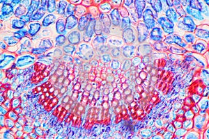 Preparation of Leaf of Winter Jasmine