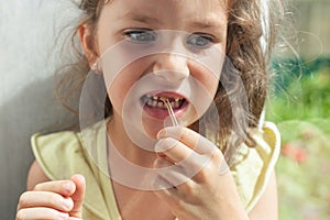 A preschool girl pulls the string. The thread is tied on the milk tooth. tooth extraction at home