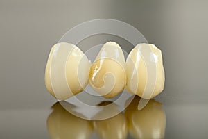 Pressed ceramic crown