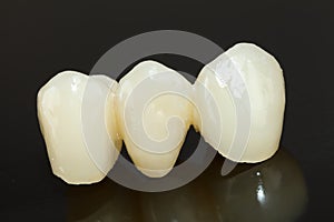 Pressed ceramic teeth