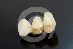Pressed ceramic teeth