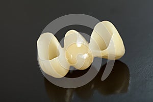 Pressed ceramic teeth