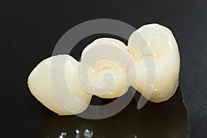 Pressed ceramic teeth