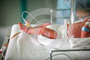 Preterm baby