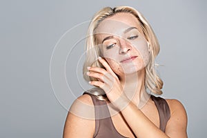 Pretty blonde woman with problem skin