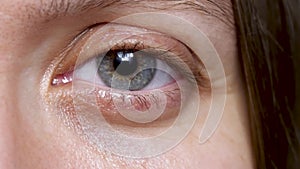 Pretty female with gray eye looking at camera and smiles, pupil with iris