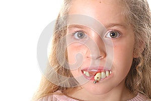 Pretty little girl with ugly teeth (copy space left)