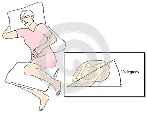 Prevention of bed sores photo