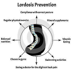 Prevention of lordosis. Spinal curvature, kyphosis, lordosis, scoliosis, arthrosis. Improper posture and stoop