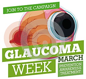 Preventive Propaganda with Sick Eyeball for Glaucoma Week, Vector Illustration