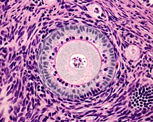 Primary ovary follicle photo