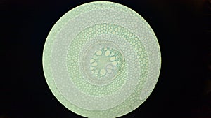 Primary structure of iris root, microscopic photography