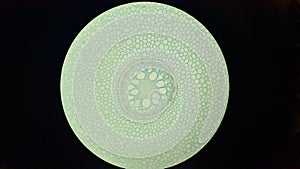 Primary structure of iris root, microscopic photography photo