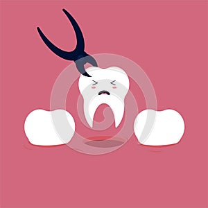 Tooth extraction or tooth pulling