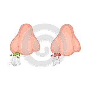Runny Nose And Nosebleed with Tissue Symbol Cartoon illustration Vector photo