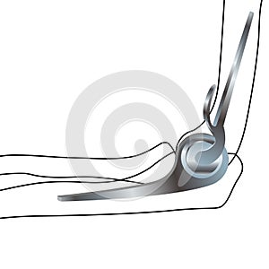 Endoprosthetics, elbow joint prosthesis. Vector illustration.