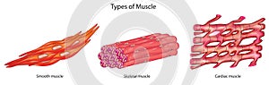 Types of Muscle