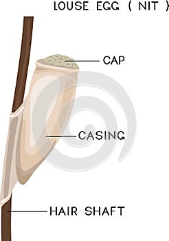 Structure of head louse egg (nit) attached to a hair