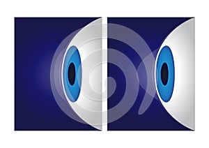 Eye cornea and keratoconus vector / anatomy photo