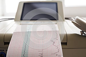 Printing of cardiogram report coming out from Electrocardiograph in labour ward