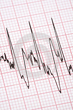 Printout from cardiograph