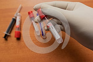 Pro-coagulation Plain Clot Activator blood collection tube,with red plastic stopper held by hand In Laboratory photo