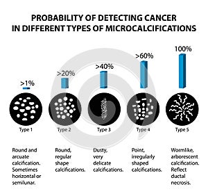 The probability of detecting breast cancer with different types of microcalcinates. Mammography. Infographics.