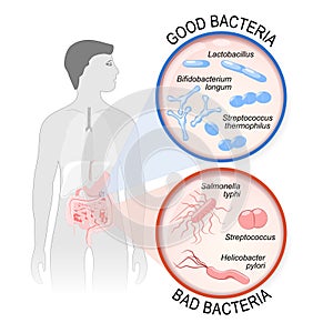 Probiotics. gut flora: Good and Bad bacteria. photo