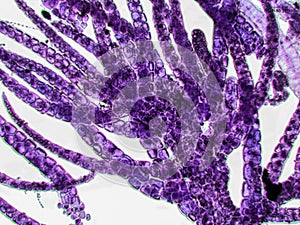 Probiotics, lactic acid bacteria. Algae, bacteria and microorganisms. Microscopic probiotics, bacterial flora photo