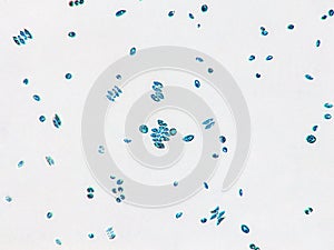 Probiotics, lactic acid bacteria. Algae, bacteria and microorganisms. Microscopic probiotics, bacterial flora photo
