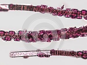 Probiotics, lactic acid bacteria. Algae, bacteria and microorganisms. Microscopic probiotics, bacterial flora photo
