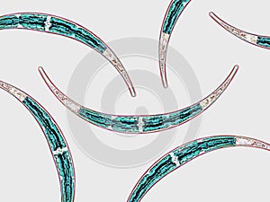 Probiotics, lactic acid bacteria. Algae, bacteria and microorganisms. Microscopic probiotics, bacterial flora photo