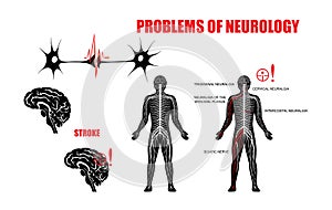 PROBLEMS OF NEUROLOGY