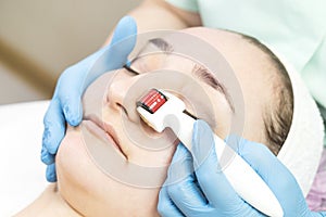 Procedure of medical micro needle therapy with a modern medical instrument derma roller