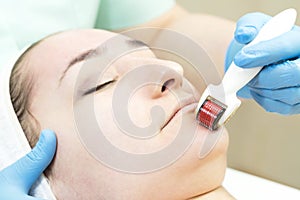 Procedure of medical micro needle therapy with a modern medical instrument derma roller