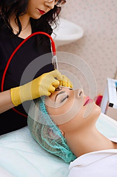 Procedure of Microdermabrasion.