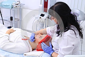 Procedure of Microdermabrasion.