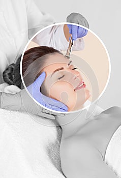 Procedure Microdermabrasion of the face skin of a beautiful woman in a beauty salon.Cosmetology and professional skin care