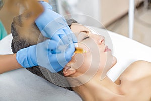 Procedure Plasmolifting injection. plasma injection into the skin of cheeks of the patient