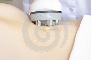 Procedure removing cellulite on female abdomen