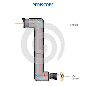 the procedure to perform a periscope in the eye