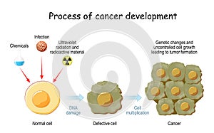 Process of cancer cell development photo