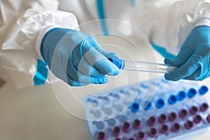 Process of coronavirus PCR antigen testing examination by nurse medic in laboratory lab, COVID-19 swab collection kit, test tube