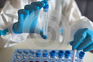 Process of coronavirus PCR antigen testing examination by nurse medic in laboratory lab, COVID-19 swab collection kit, test tube