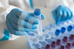 Process of coronavirus PCR antigen testing examination by nurse medic in laboratory lab, COVID-19 swab collection kit, test tube