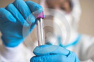 Process of coronavirus PCR antigen testing examination by nurse medic in laboratory lab, COVID-19 swab collection kit, test tube