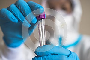 Process of coronavirus PCR antigen testing examination by nurse medic in laboratory lab, COVID-19 swab collection kit, test tube