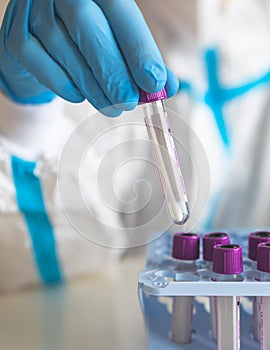 Process of coronavirus PCR antigen testing examination by nurse medic in laboratory lab, COVID-19 swab collection kit, test tube