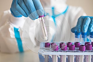 Process of coronavirus PCR antigen testing examination by nurse medic in laboratory lab, COVID-19 swab collection kit, test tube